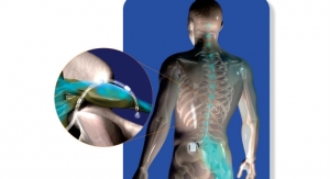FDA Approval of St. Jude’s Neurostimulator Device for Chronic Intractable Pain