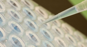 Urine Test Improves Prediction of High-Grade Prostate Cancer 