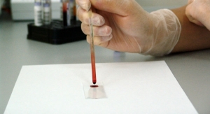 New Autism Blood Biomarker Could Lead to Earlier Diagnosis