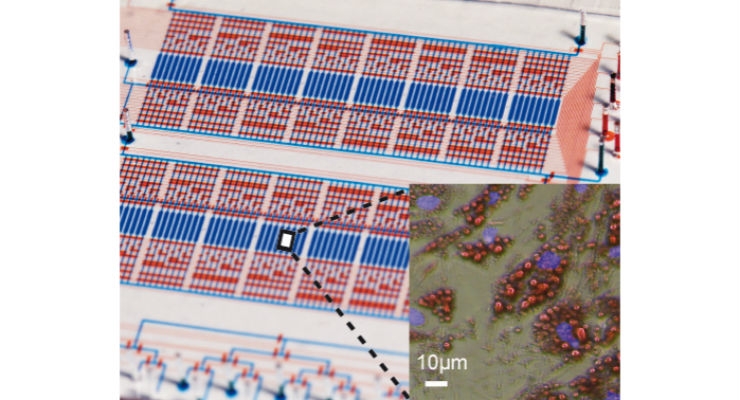 Microfluidic Chip Adipose Analysis May Help Combat Obesity and Diabetes