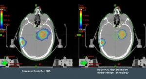  Varian Exhibiting New HyperArc Technology for High Definition Radiotherapy and Radiosurgery