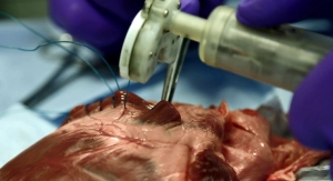 3D Printing Custom Instruments for Keyhole Heart Surgery