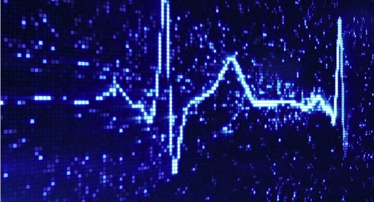  Cardiologs ECG Analysis Platform Receives FDA Clearance 