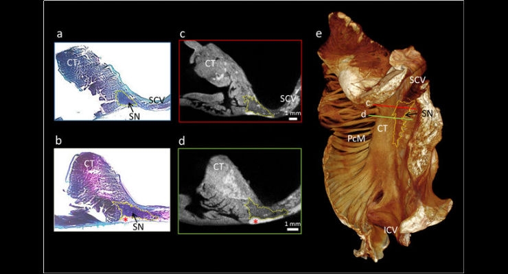 Patients to Benefit from New 3D Visualizations of the Heart