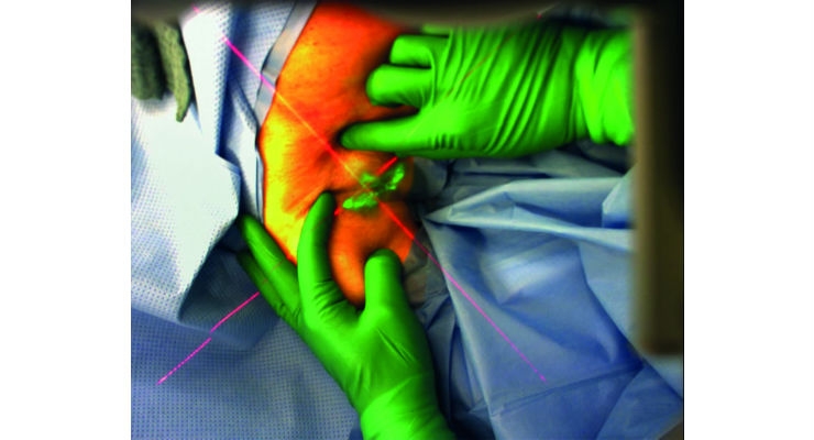 AR Glasses Help Surgeons When Operating on Tumors