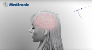 Medtronic Launches MRI-Guided Laser Ablation System for Brain Surgery in Europe