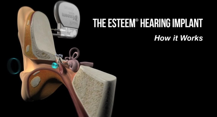 Fully Implanted Esteem Hearing Device Receives FDA Approval for MR-Conditional Labeling