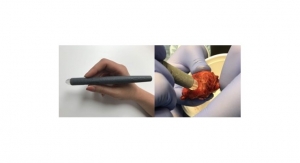 ‘MasSpec Pen’ for Accurate Cancer Detection During Surgery
