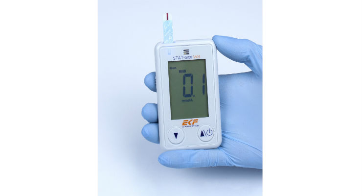 EKF Launches β-Ketone and Glucose POC Analyzer to U.S. Market