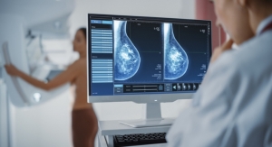 SimBioSys, Mayo Clinic Team Up on AI-Powered Breast Cancer Tool