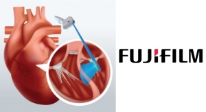 Fujifilm Rolls Out First-of-its-Kind Transducer for OPIE for Septal Myectomy