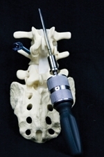 Double Drive Medical Adapts Drill Technology for Surgical Arena
