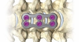 FDA OKs New Cervical Plate From X-spine Systems