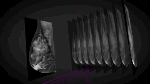 Nuclear Physicist Seeks to Build a Better Mammography Machine (with video)