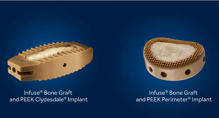 FDA Approves Infuse Bone Graft for Three New Spine Surgery Indications