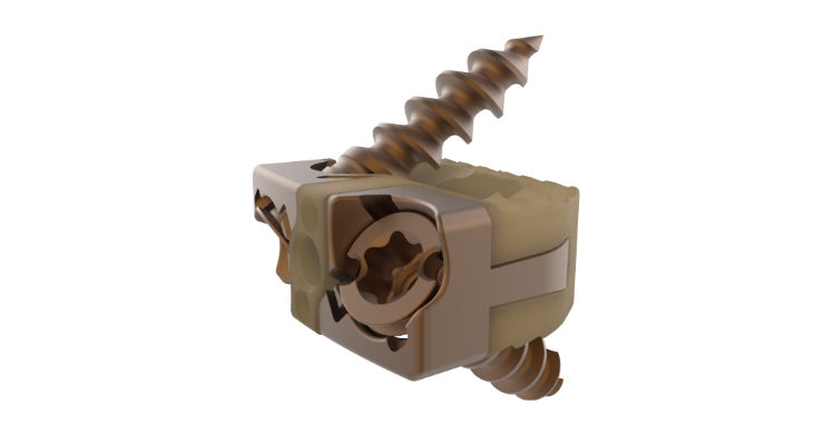 Stand-Alone Cervical Device Receives 510(k) Clearance