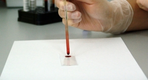 Blood Test Effective at Tracking Spread of Melanoma 