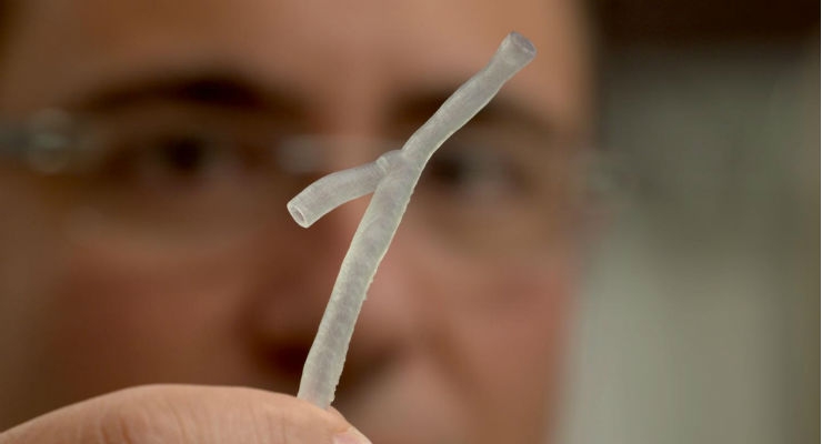 Cardiologists 3D Print a Personalized Treatment for Heart Disease 