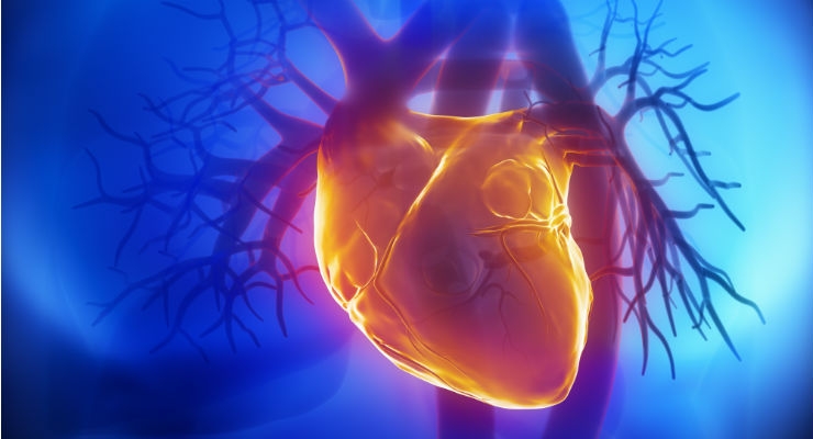 New Heart Pump Designed to Allow Remote Monitoring Enters Trial