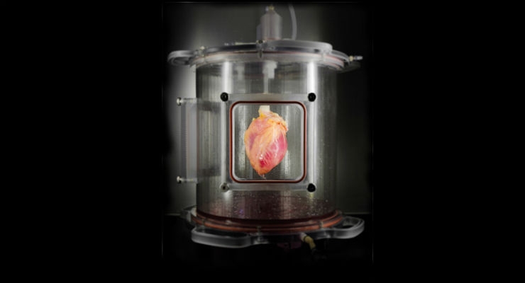 Functional Heart Muscle Regenerated in Decellularized Human Hearts