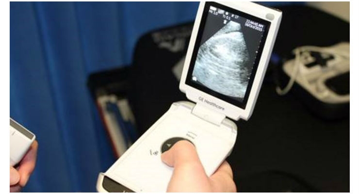 Pocket-Sized Scanner Used to Spot Breech Babies