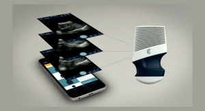 Wireless, Handheld Ultrasound for iOS and Android Debuts