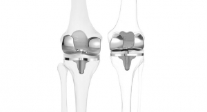 Custom Knee Implants Offer More Natural Movement