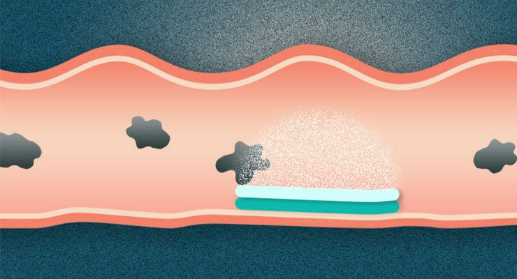 New Pill Attaches to GI Tract for Long-Term Drug Release
