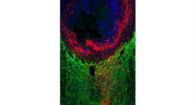 New Role Identified for Scars at the Site of Injured Spinal Cord 