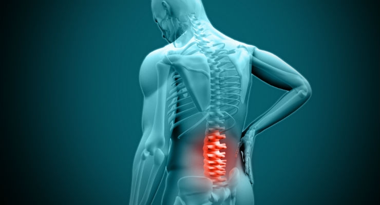 Study Tests Stem Cells as a Treatment for Degenerative Disc Disease
