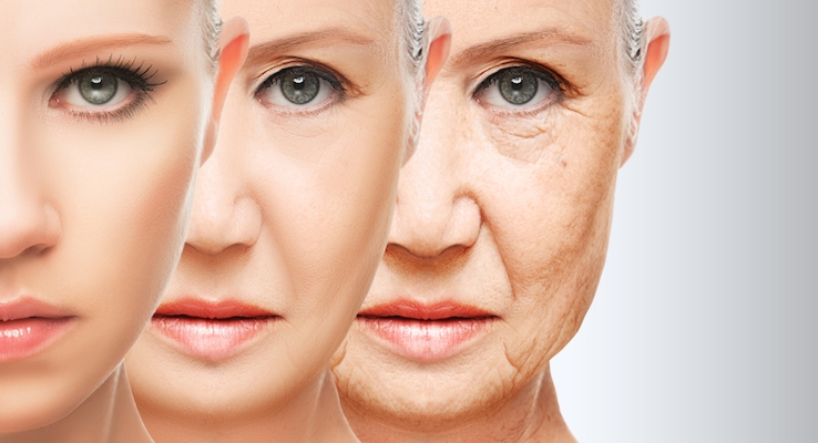 Aging and the MC1R Gene