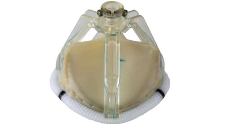 St. Jude Medical Launches Trifecta Surgical Valve With Glide Technology
