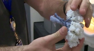 3D-Printed Kidney Helps Save Woman