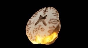 ‘Meta-Realistic Medical Moving Images’ Make the Brain Glow