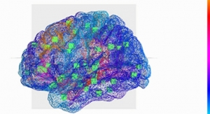 A Virtual Brain Helps Decrypt Epilepsy