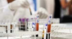 New Blood Test Could Help Prevent Organ Transplant Rejection