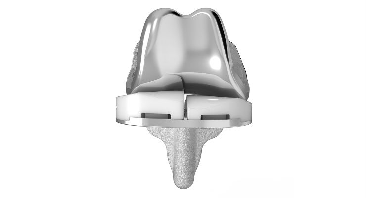 Positive Results from Customized Knee Implant Clinical Studies