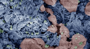Nanoparticles Could Speed Blood Clotting to Halt Internal Bleeding