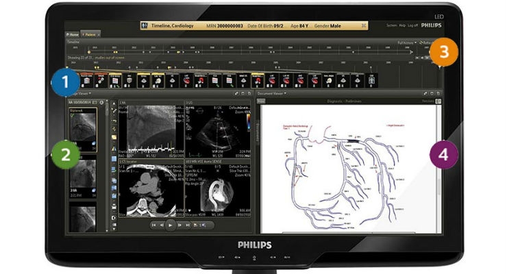 Philips Introduces Diagnostic Quality Web-Based Echo Reporting for IntelliSpace