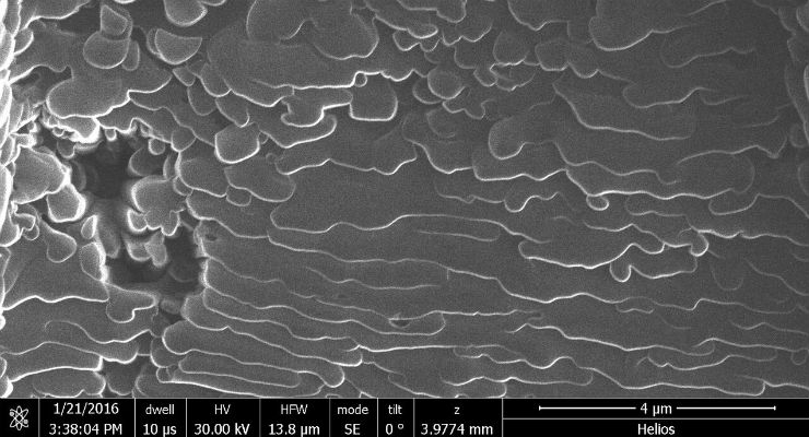 3D Graphene Could Replace Titanium as Bone Replacement Material