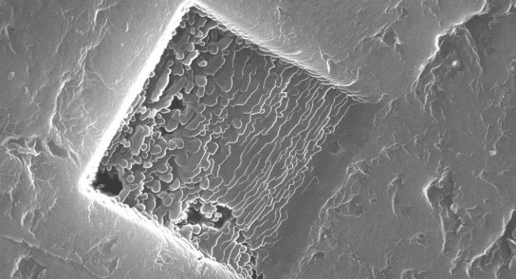 3D Graphene Could Replace Titanium as Bone Replacement Material