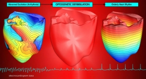 Using Light to Restore a Healthy Heartbeat