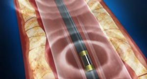 FDA Clears First Technology to Use Sound Waves to Treat Calcified Peripheral Artery Disease