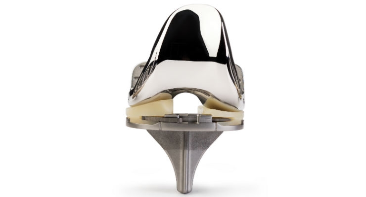 Zimmer Biomet Launches Vanguard Individualized Design Knee Replacement 