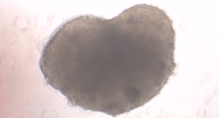 Stem Cell ‘Heart Patch’ Moves Closer to Clinic