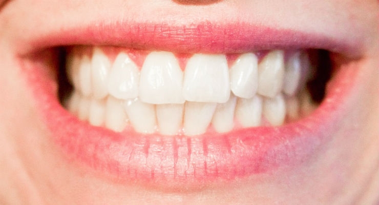 First Data on New Dental Fillings that Will Repair Tooth Decay