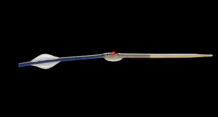 Lights, Camera, Action: New Catheter Lets Doctors See Inside Arteries for First Time