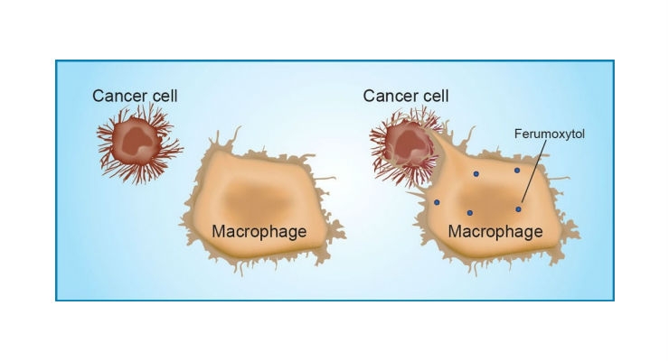 Iron Nanoparticles Make Immune Cells Attack Cancer