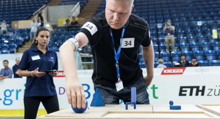 World’s First Implanted Bionic Arm Tested in Global 