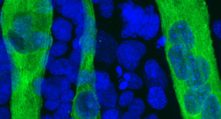 Stem Cell Gene Found to Command Skeletal Muscle Regeneration
